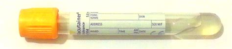 clotting screen blood test bottle|blood bottle toxicology test.